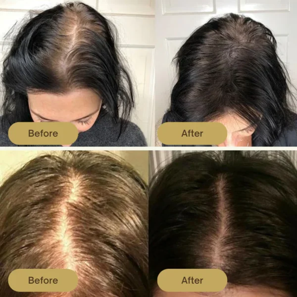 Houdini Vegan Hair Growth Oil - Image 3